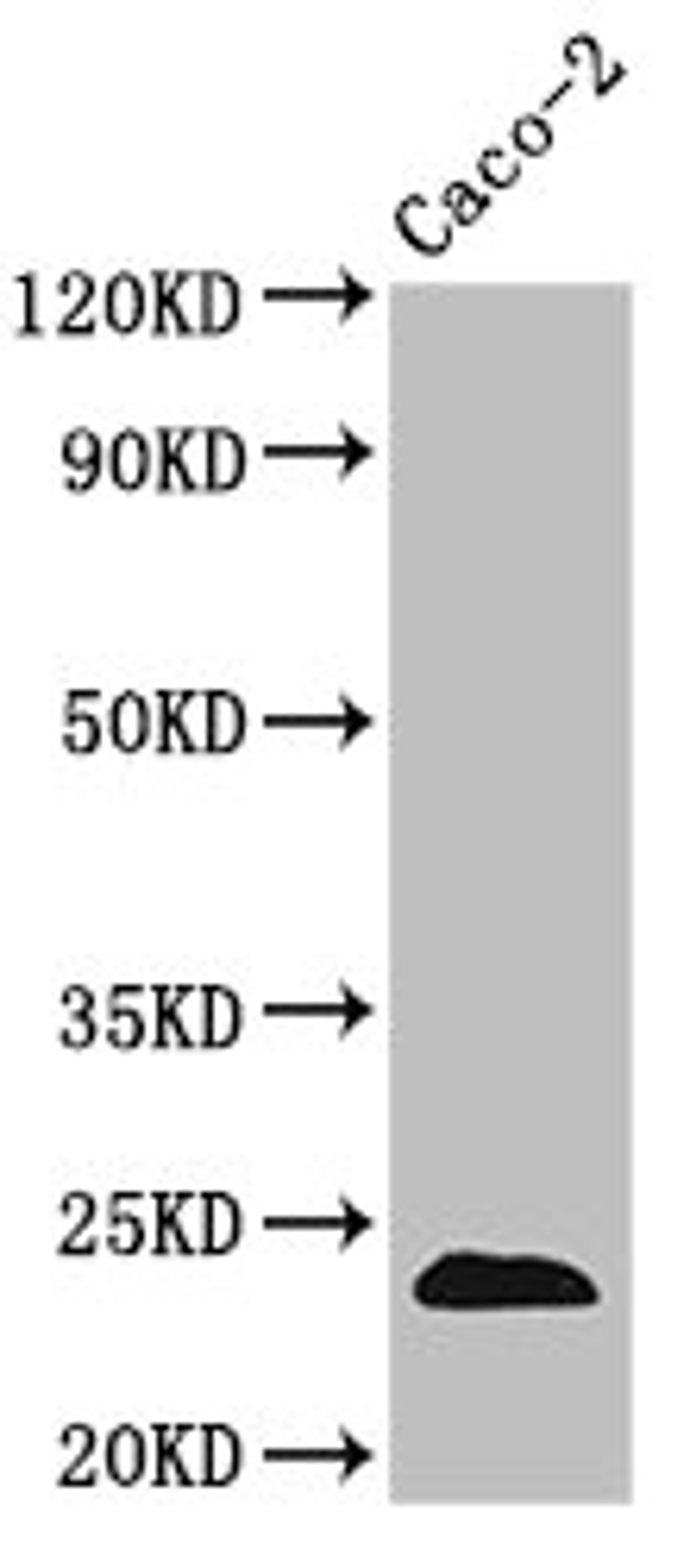 Western Blot. Positive WB detected in: Caco-2 whole cell lysate. All lanes: CLDN3 antibody at 3.5µg/ml. Secondary. Goat polyclonal to rabbit IgG at 1/50000 dilution. Predicted band size: 24 kDa. Observed band size: 24 kDa