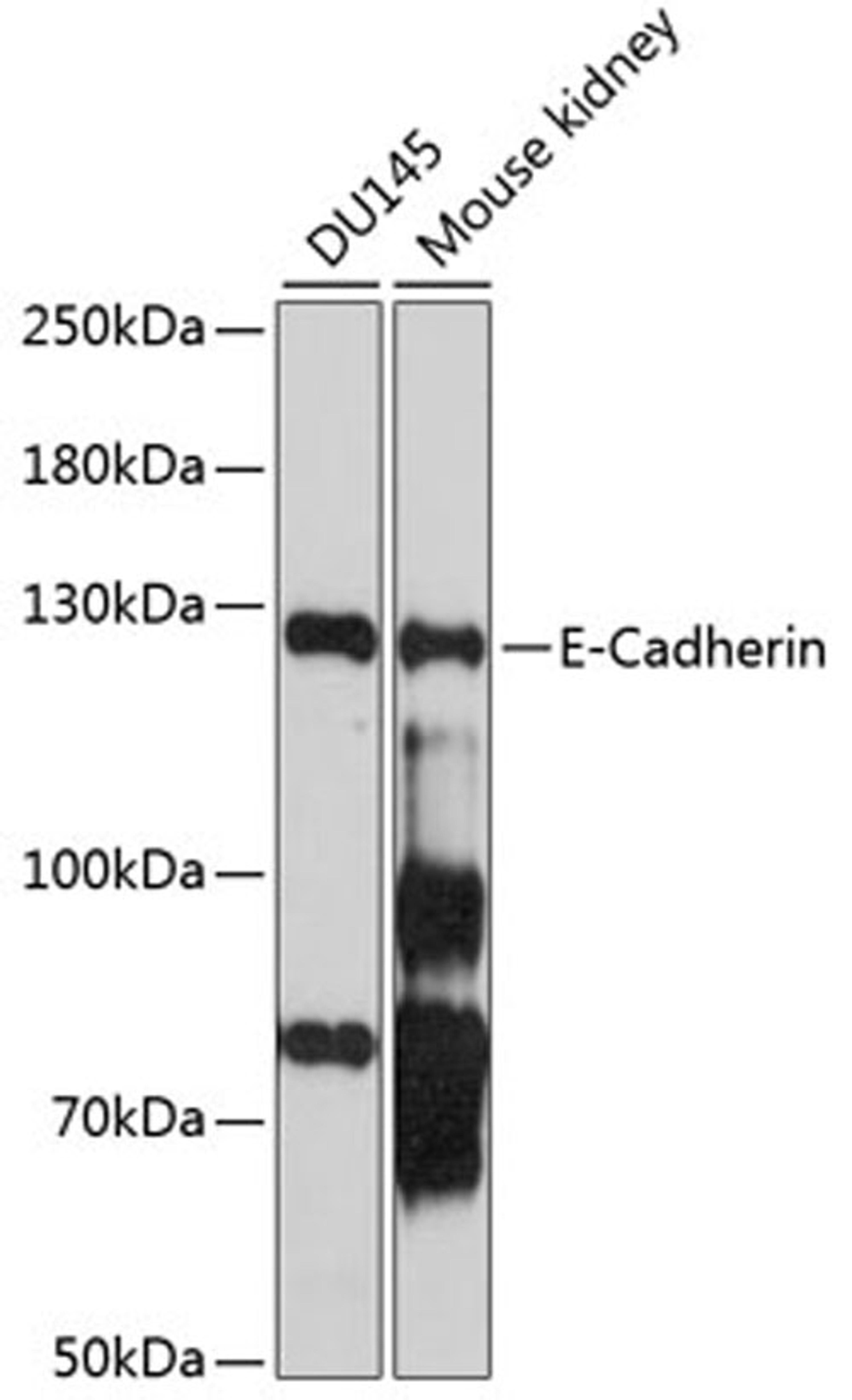 Western blot - E-Cadherin antibody (A3044)
