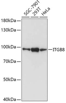 Western blot - ITGB8 antibody (A8433)