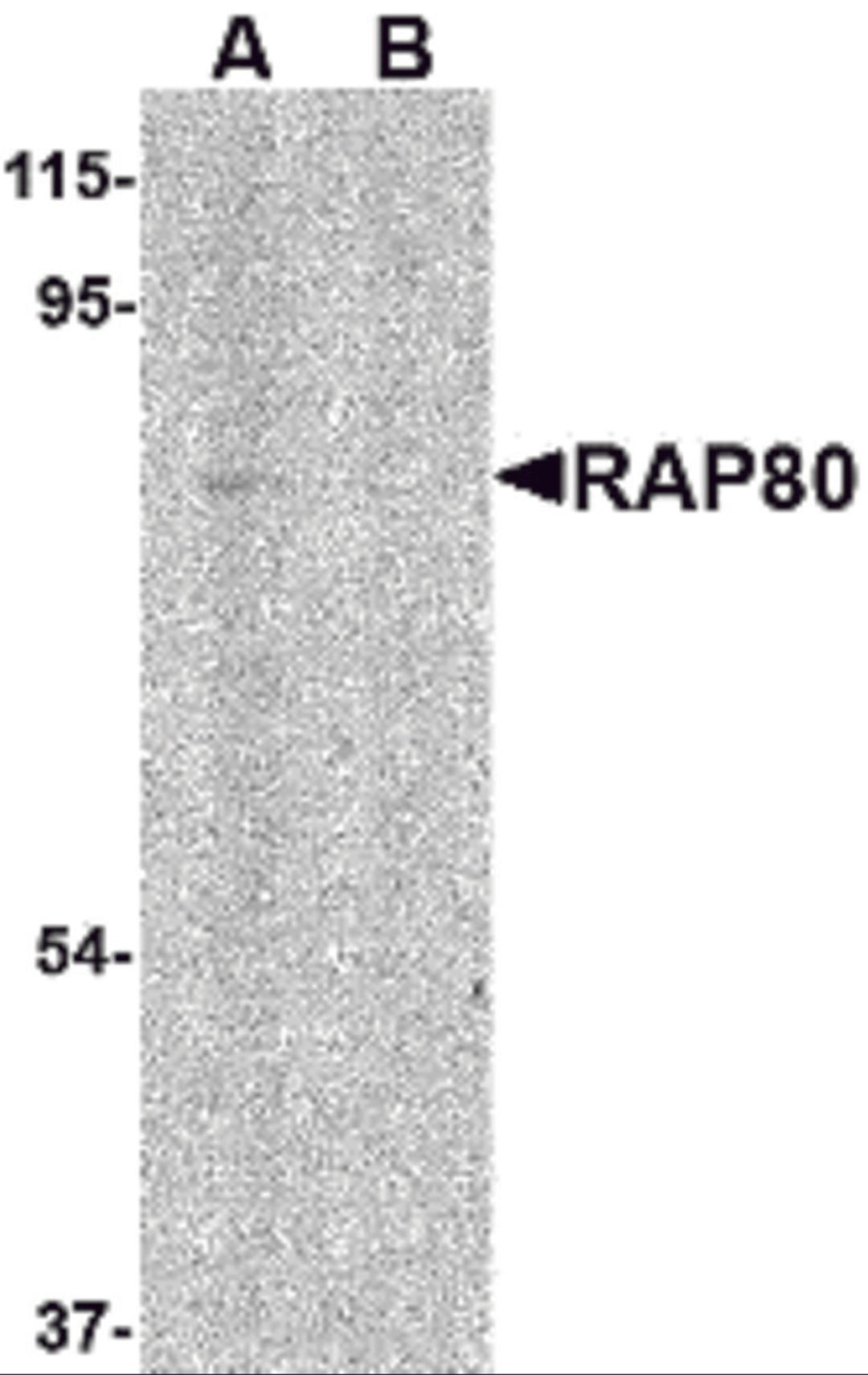 Western blot analysis of RAP80 in 293 cell lysate in (A) the absence and (B) presence of blocking peptide with RAP80 antibody at 1 μg/mL.