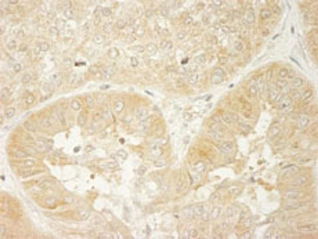 Detection of human LARP1 by immunohistochemistry.