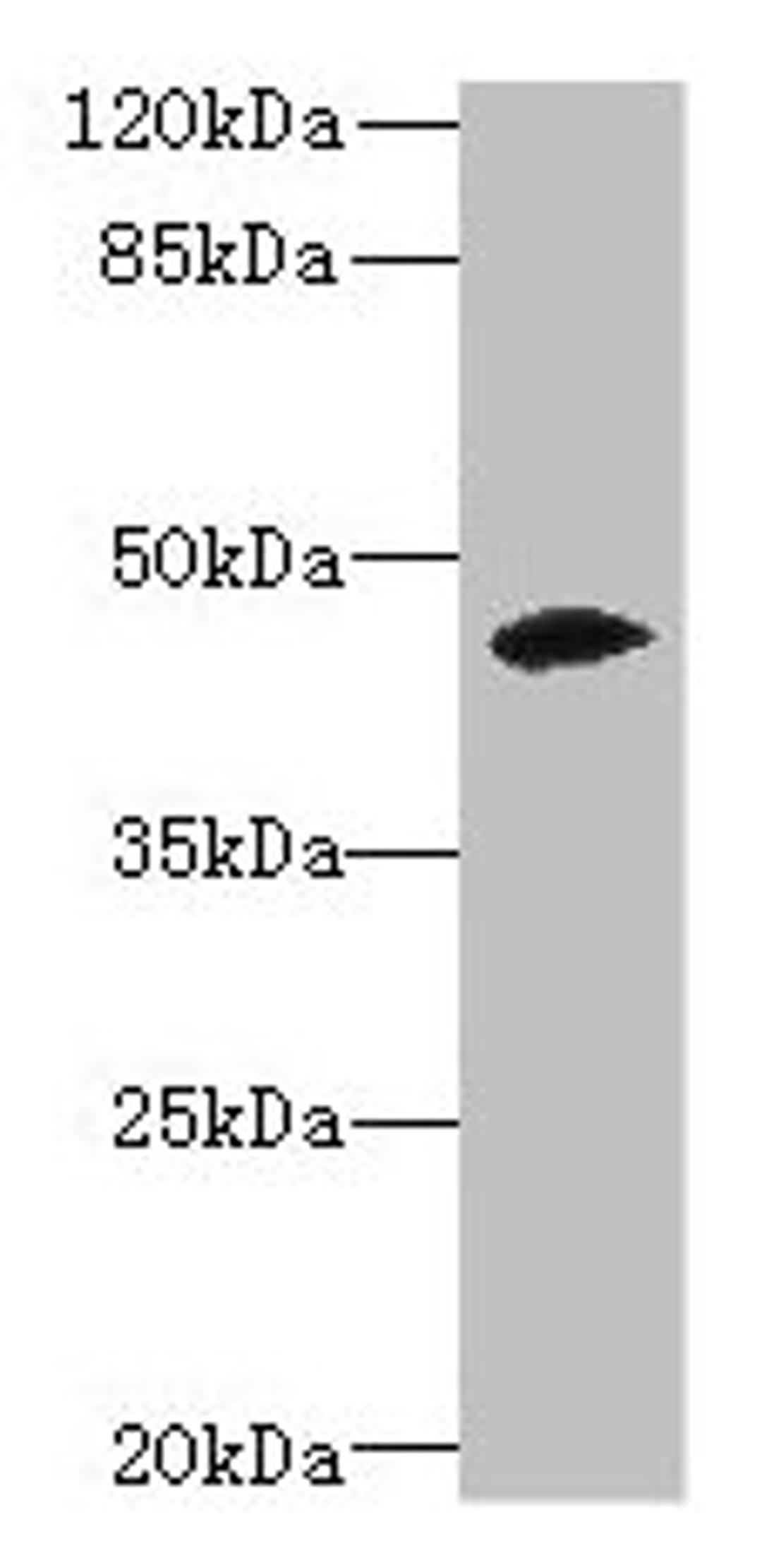 Western blot. All lanes: ZSCAN9 antibody at 0.3µg/ml + Mouse brain tissue. Secondary. Goat polyclonal to rabbit IgG at 1/10000 dilution. Predicted band size: 46, 52 kDa. Observed band size: 46 kDa