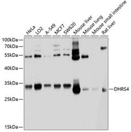 Western blot - DHRS4 antibody (A10285)