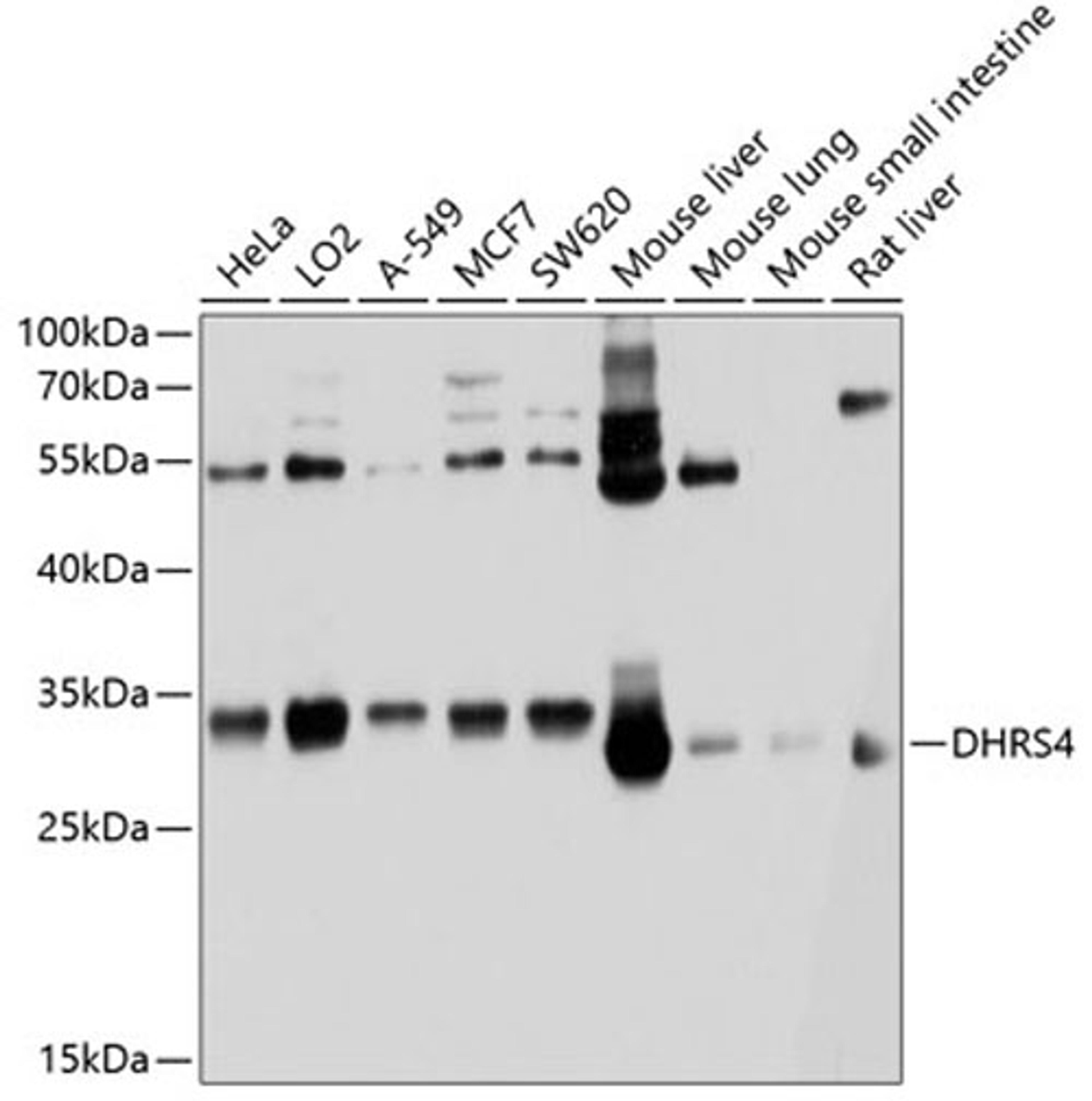 Western blot - DHRS4 antibody (A10285)