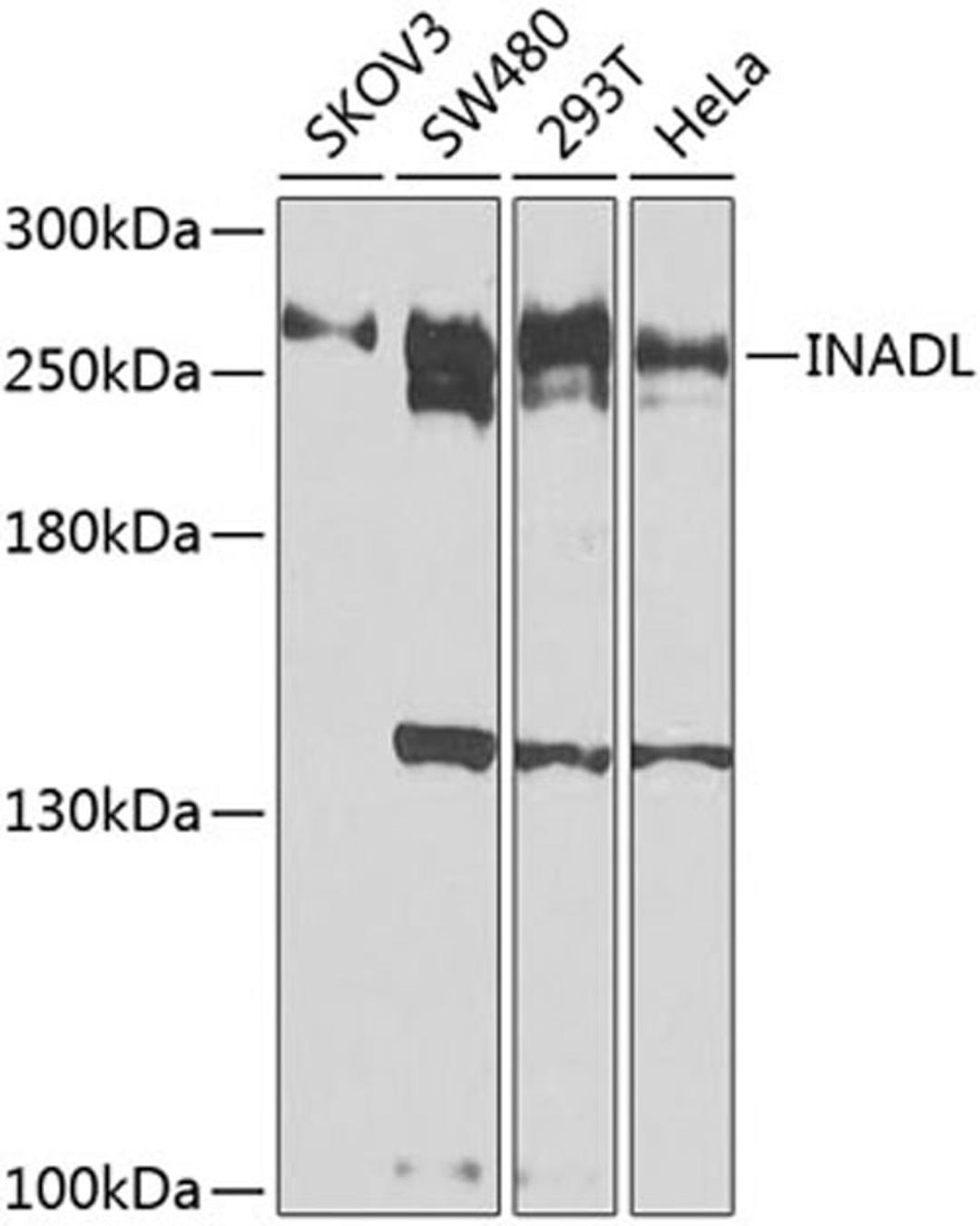 Western blot - INADL antibody (A8476)