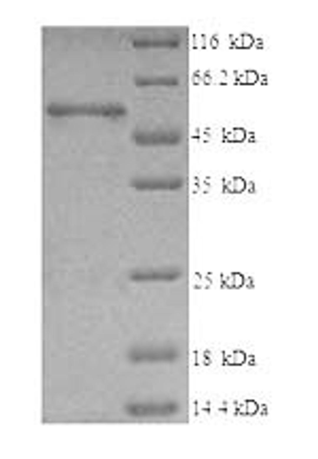 (Tris-Glycine gel) Discontinuous SDS-PAGE (reduced) with 5% enrichment gel and 15% separation gel.