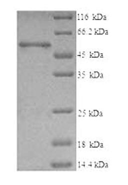(Tris-Glycine gel) Discontinuous SDS-PAGE (reduced) with 5% enrichment gel and 15% separation gel.