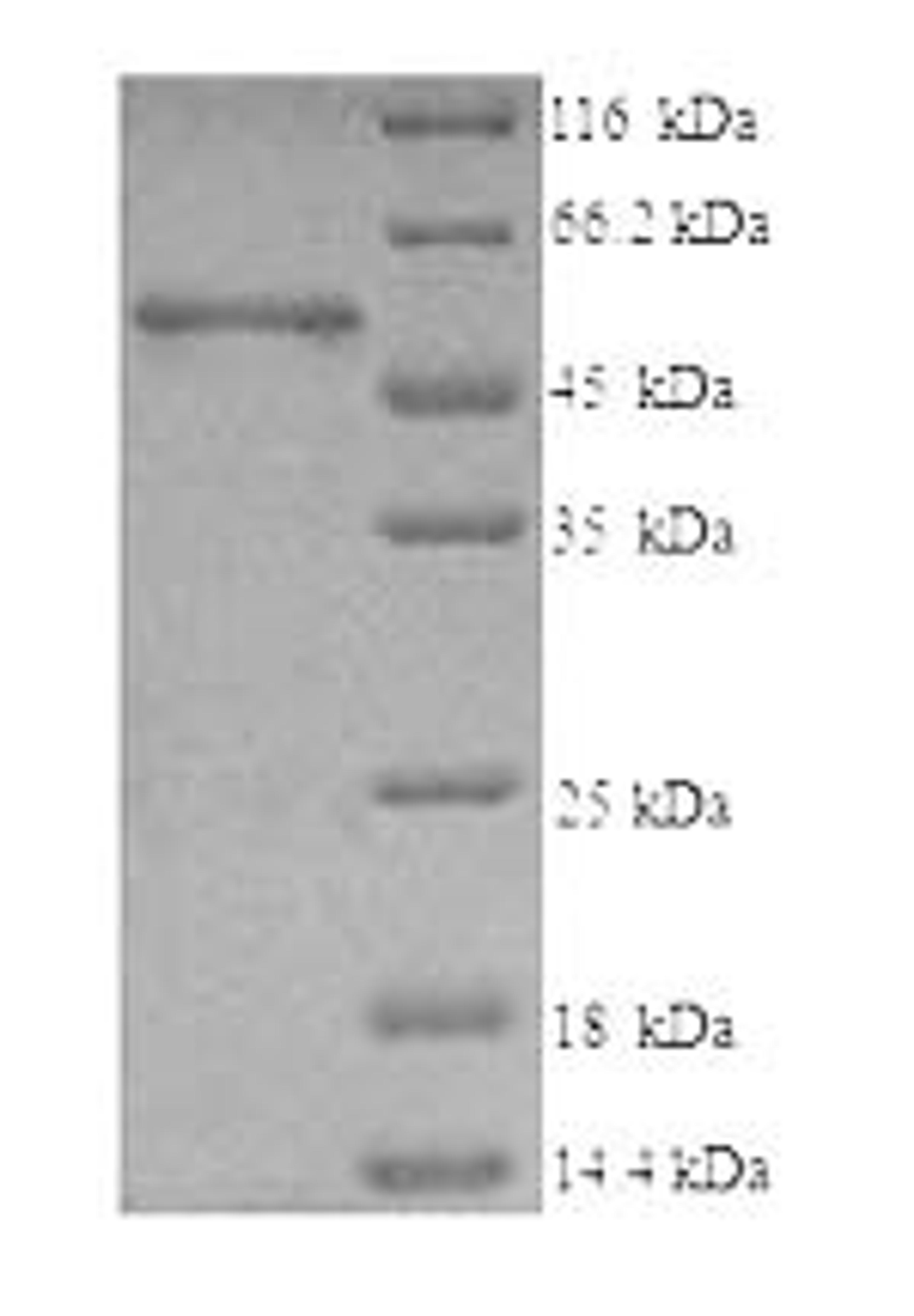 (Tris-Glycine gel) Discontinuous SDS-PAGE (reduced) with 5% enrichment gel and 15% separation gel.