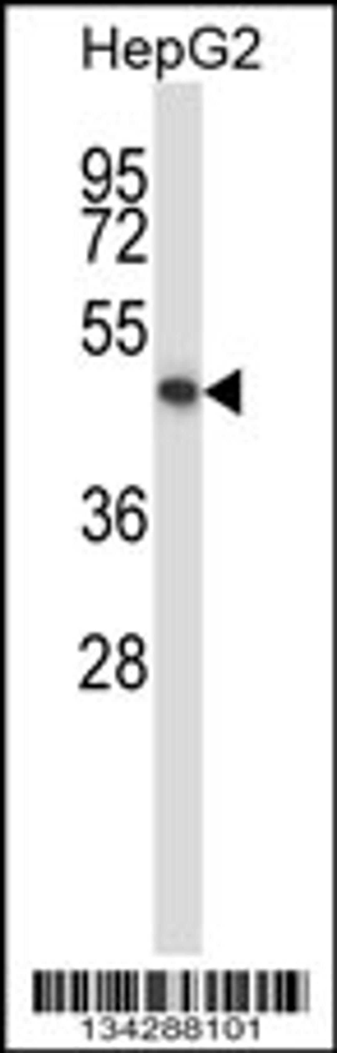 Western blot analysis in HepG2 cell line lysates (35ug/lane).