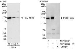 Western Blot: PGC-1 beta Antibody [NBP1-28722] - Samples: Whole cell lysate (5, 15 and 50 ug for WB; 1 mg for IP, 20% of IP loaded) from HeLa cells.   Antibodies: Affinity purified rabbit anti-PGC-1beta antibody NBP1-28722 used for WB at 0.4 ug/ml (A) and 1 ug/ml (B) and used for IP at 10 ug/mg lysate.  PGC-1beta was also immunoprecipitated by rabbit anti-PGC-1beta antibody NBP1-28721, which recognizes an upstream epitope.  Detection: Chemiluminescence with exposure times of 30 seconds (A and B).