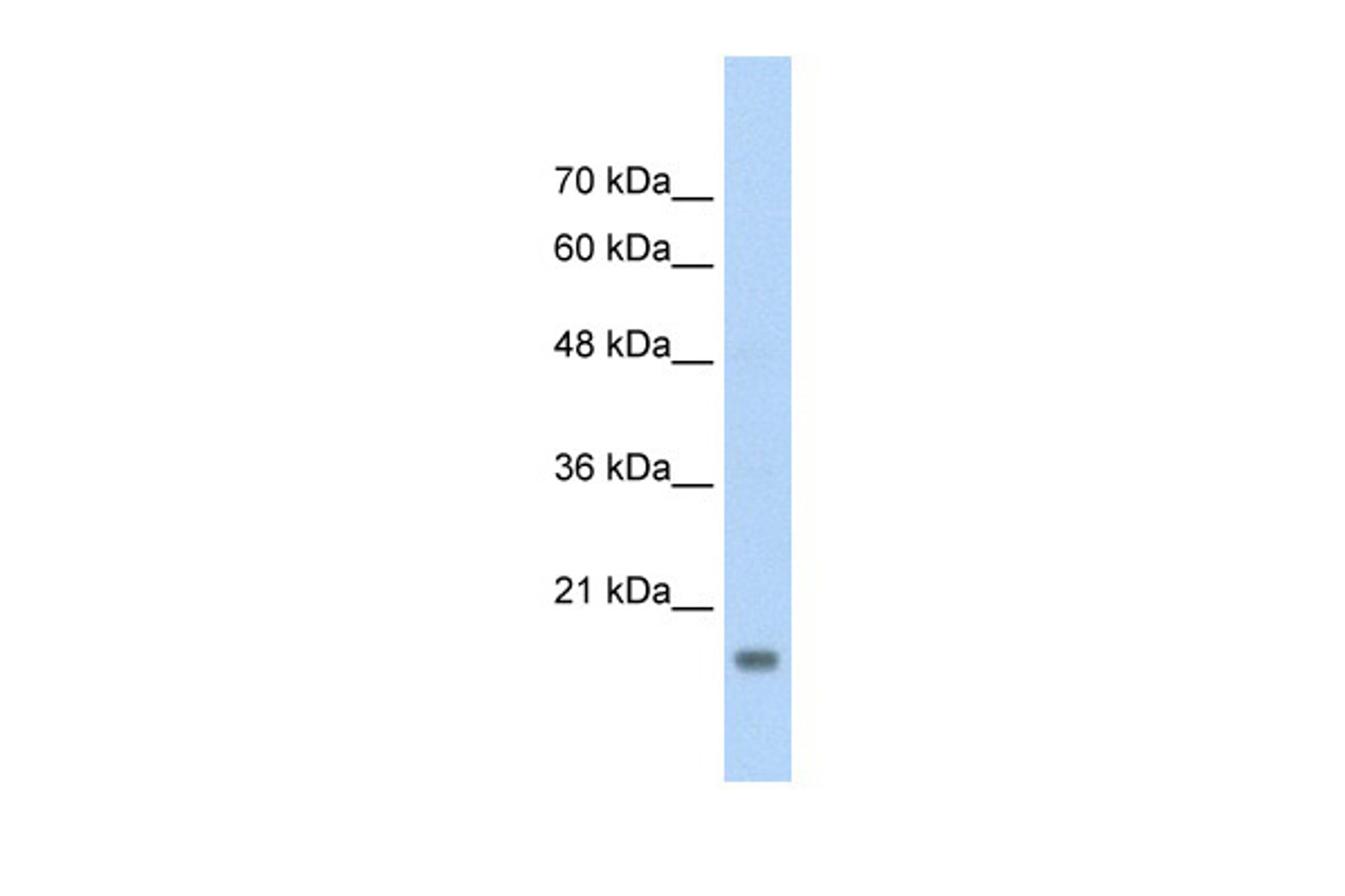 Antibody used in WB on Human HepG2 at 2.5 ug/ml.