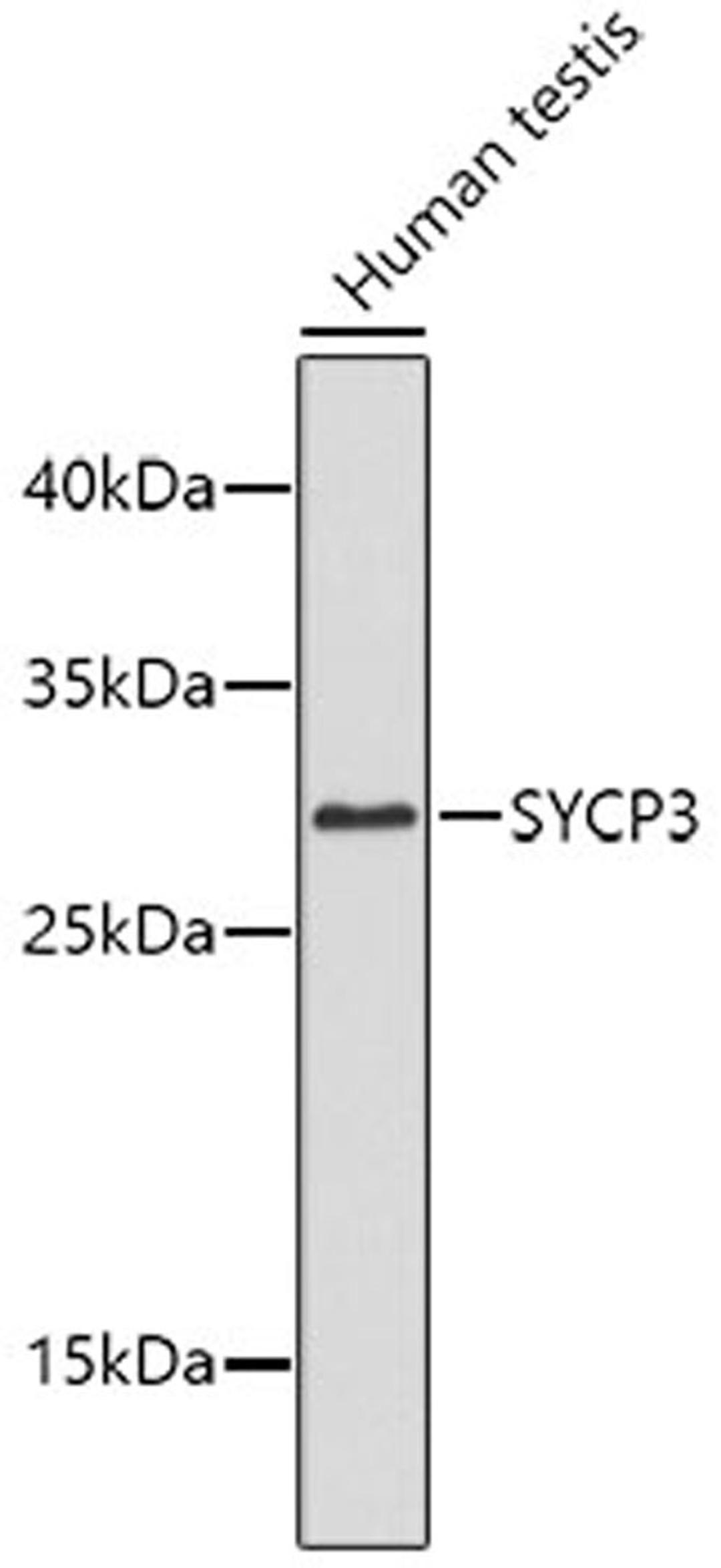 Western blot - SYCP3 antibody (A9548)