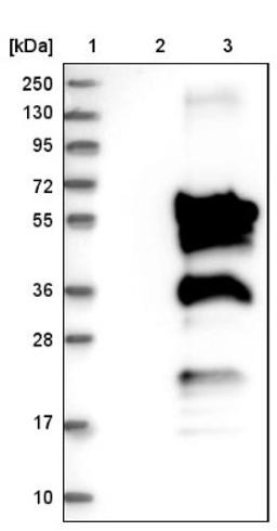 Western Blot: Migfilin Antibody [NBP1-86665] - Lane 1: Marker [kDa] 250, 130, 95, 72, 55, 36, 28, 17, 10<br/>Lane 2: Negative control (vector only transfected HEK293T lysate)<br/>Lane 3: Over-expression lysate (Co-expressed with a C-terminal myc-DDK tag (~3.1 kDa) in mammalian HEK293T cells, LY402597)