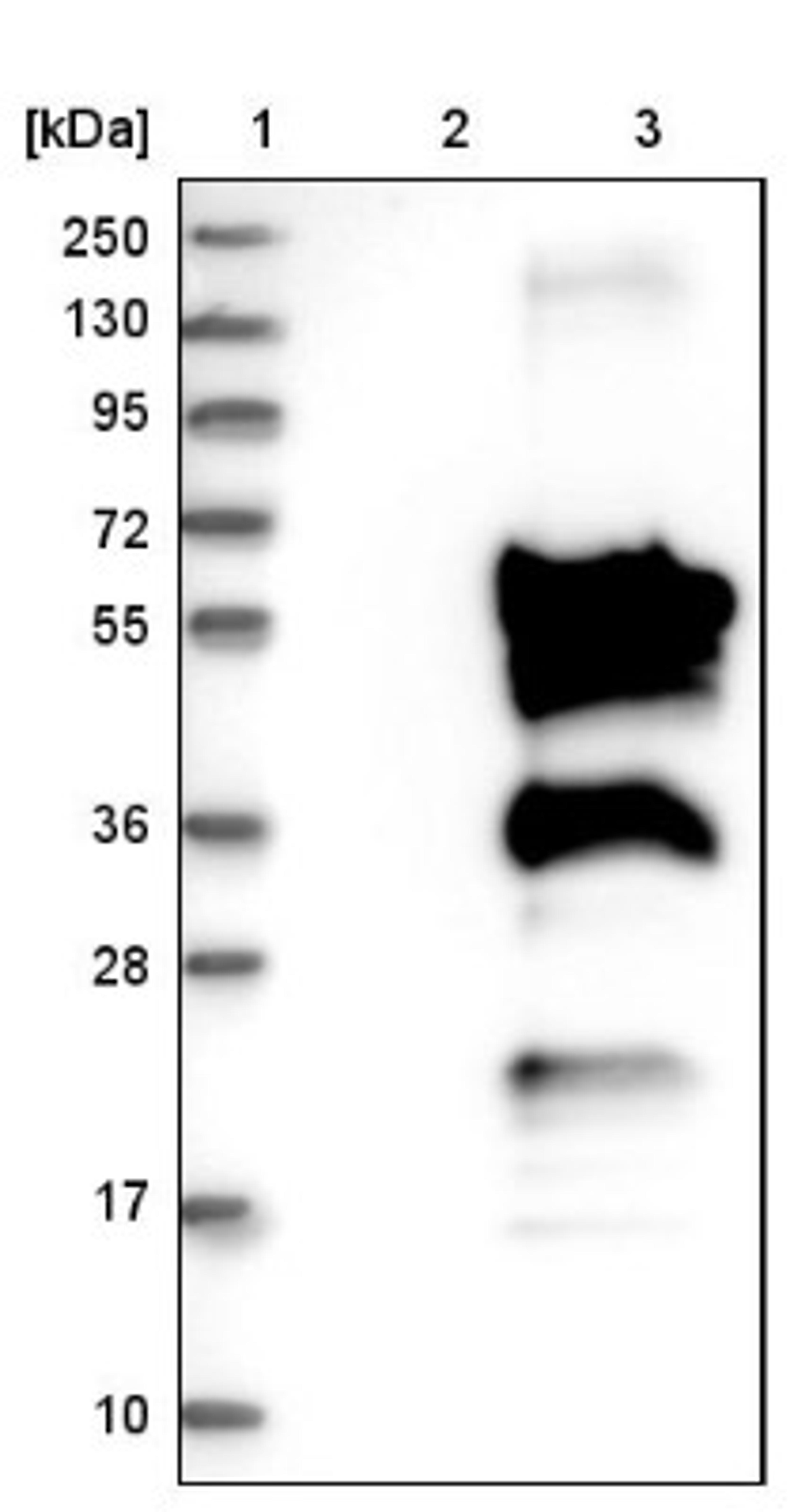 Western Blot: Migfilin Antibody [NBP1-86665] - Lane 1: Marker [kDa] 250, 130, 95, 72, 55, 36, 28, 17, 10<br/>Lane 2: Negative control (vector only transfected HEK293T lysate)<br/>Lane 3: Over-expression lysate (Co-expressed with a C-terminal myc-DDK tag (~3.1 kDa) in mammalian HEK293T cells, LY402597)