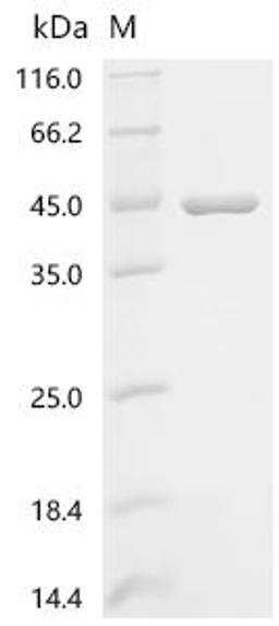 (Tris-Glycine gel) Discontinuous SDS-PAGE (reduced) with 5% enrichment gel and 15% separation gel.