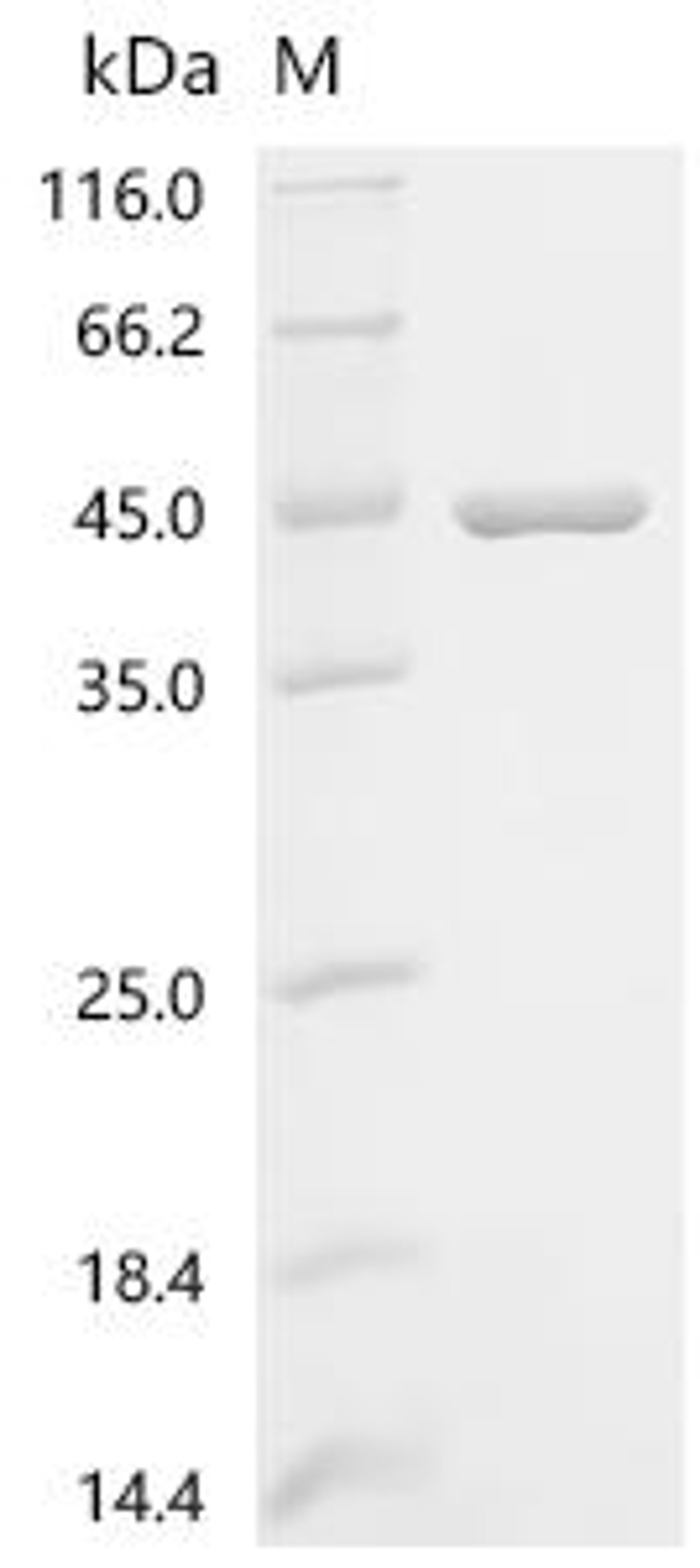(Tris-Glycine gel) Discontinuous SDS-PAGE (reduced) with 5% enrichment gel and 15% separation gel.