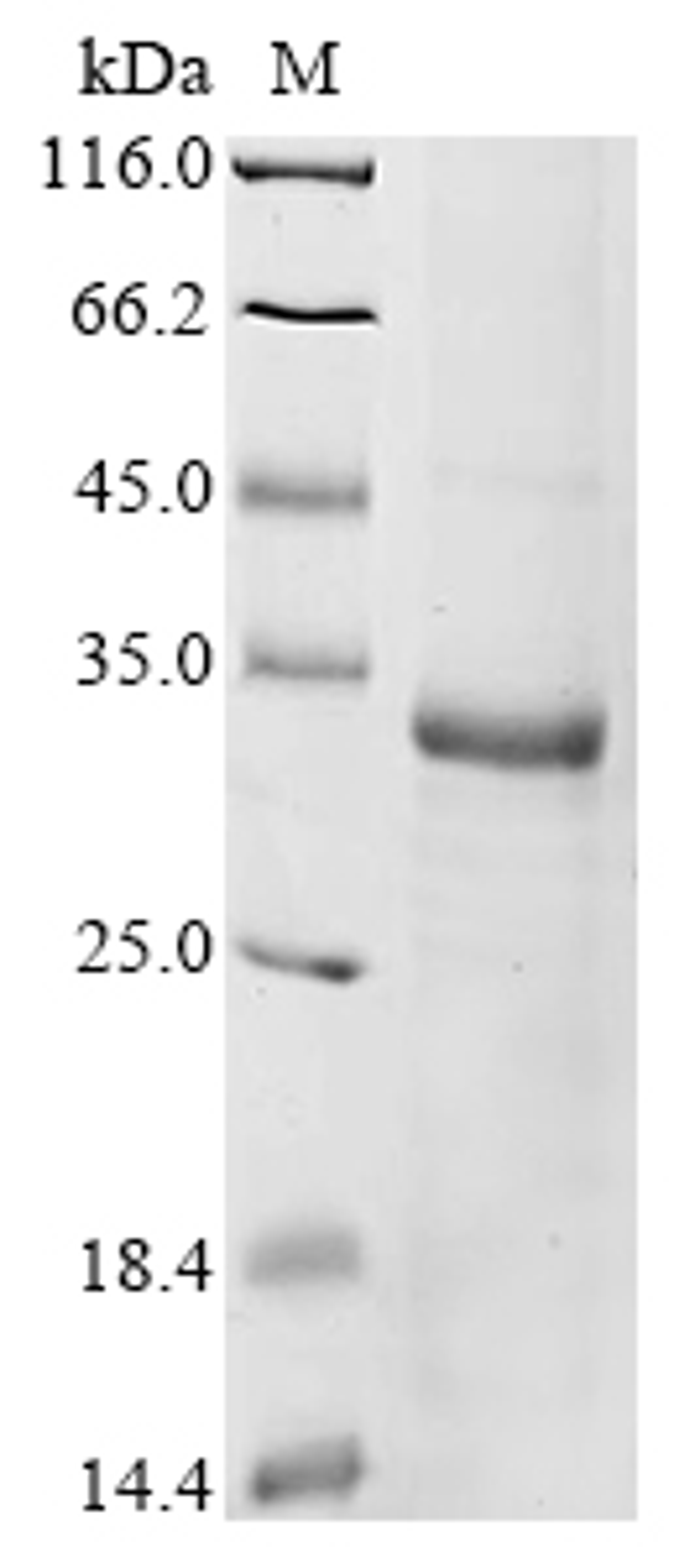 (Tris-Glycine gel) Discontinuous SDS-PAGE (reduced) with 5% enrichment gel and 15% separation gel.