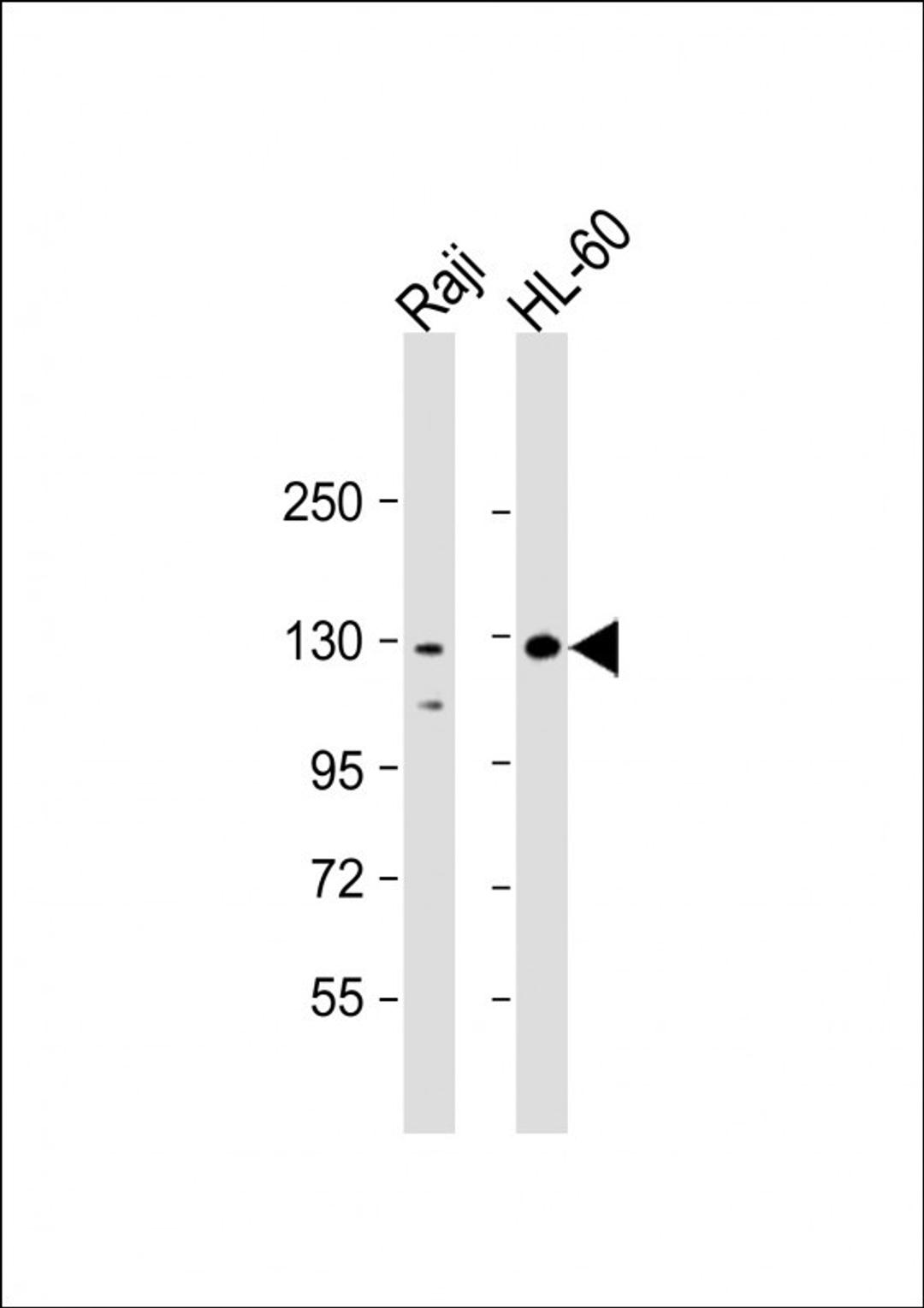 Western Blot at 1:2000 dilution Lane 1: Raji whole cell lysate Lane 2: HL-60 whole cell lysate Lysates/proteins at 20 ug per lane.