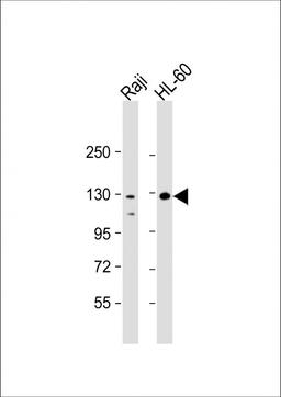 Western Blot at 1:2000 dilution Lane 1: Raji whole cell lysate Lane 2: HL-60 whole cell lysate Lysates/proteins at 20 ug per lane.