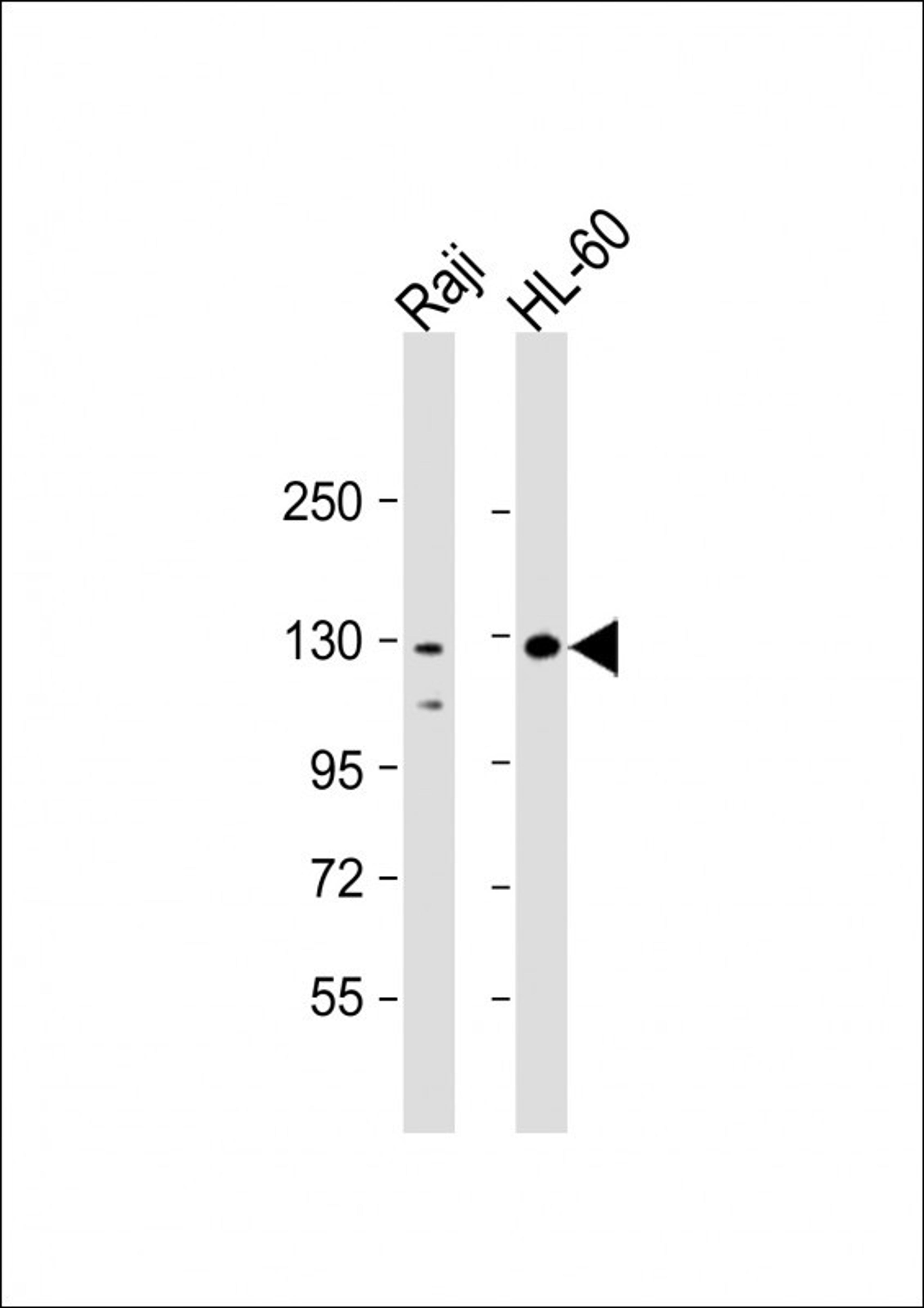 Western Blot at 1:2000 dilution Lane 1: Raji whole cell lysate Lane 2: HL-60 whole cell lysate Lysates/proteins at 20 ug per lane.