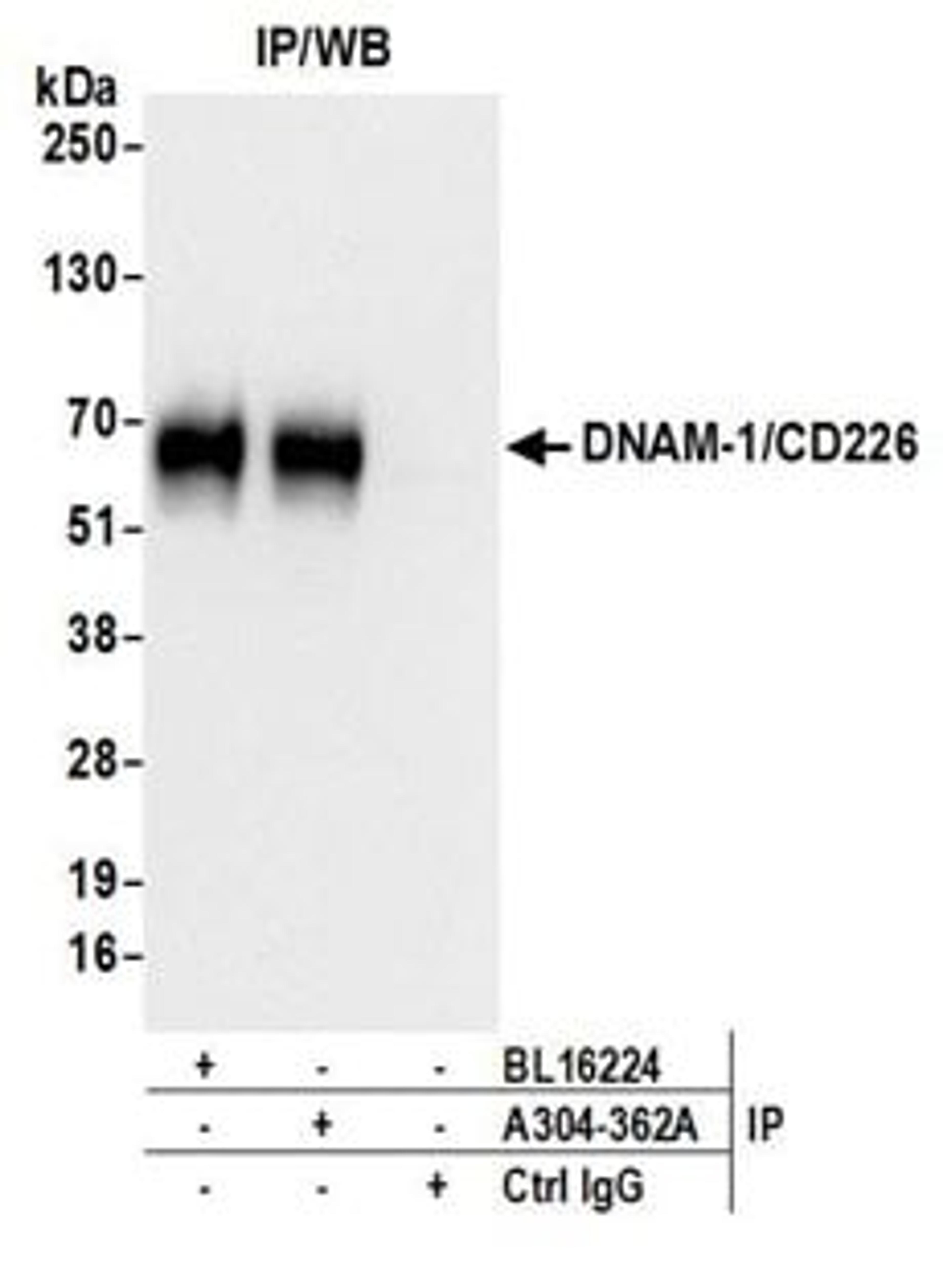 Detection of human DNAM-1/CD226 by western blot of immunoprecipitates.