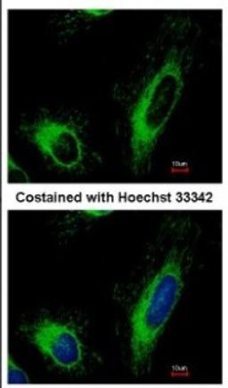 Immunocytochemistry/Immunofluorescence: SLC25A6 Antibody [NBP2-20393] - Immunofluorescence analysis of methanol-fixed HeLa, using antibody at 1:500 dilution.