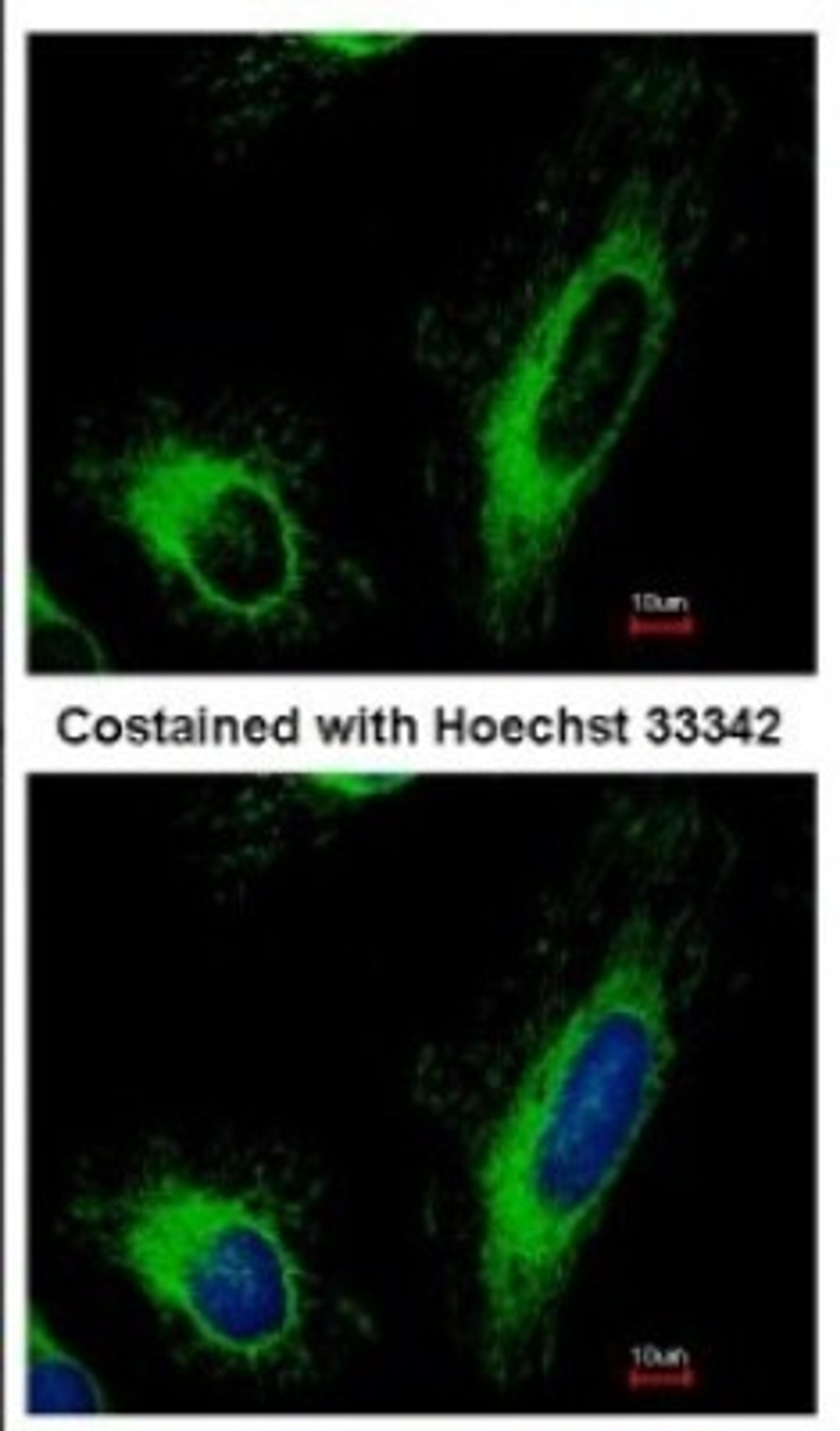 Immunocytochemistry/Immunofluorescence: SLC25A6 Antibody [NBP2-20393] - Immunofluorescence analysis of methanol-fixed HeLa, using antibody at 1:500 dilution.