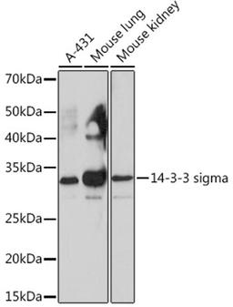 Western blot - 14-3-3 sigma Rabbit mAb (A4377)