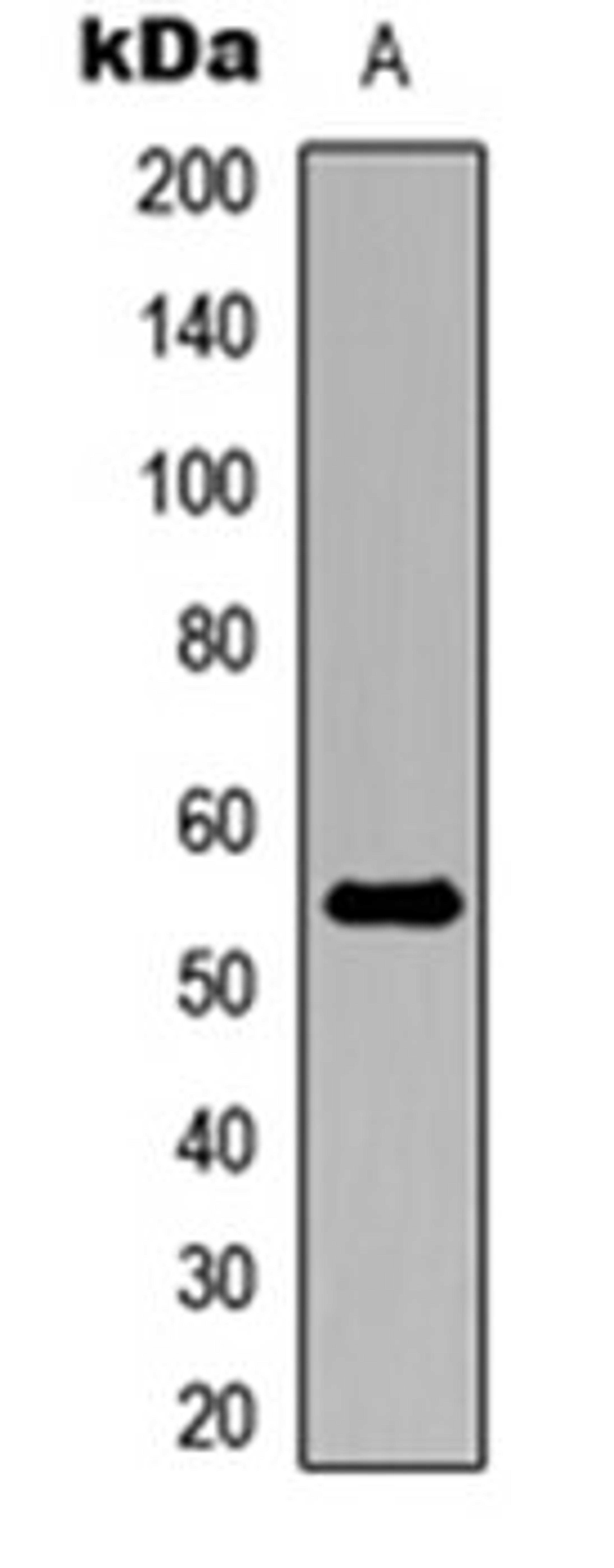 Western blot analysis of MCF7 (Lane 1) whole cell lysates using ALDH1A2 antibody