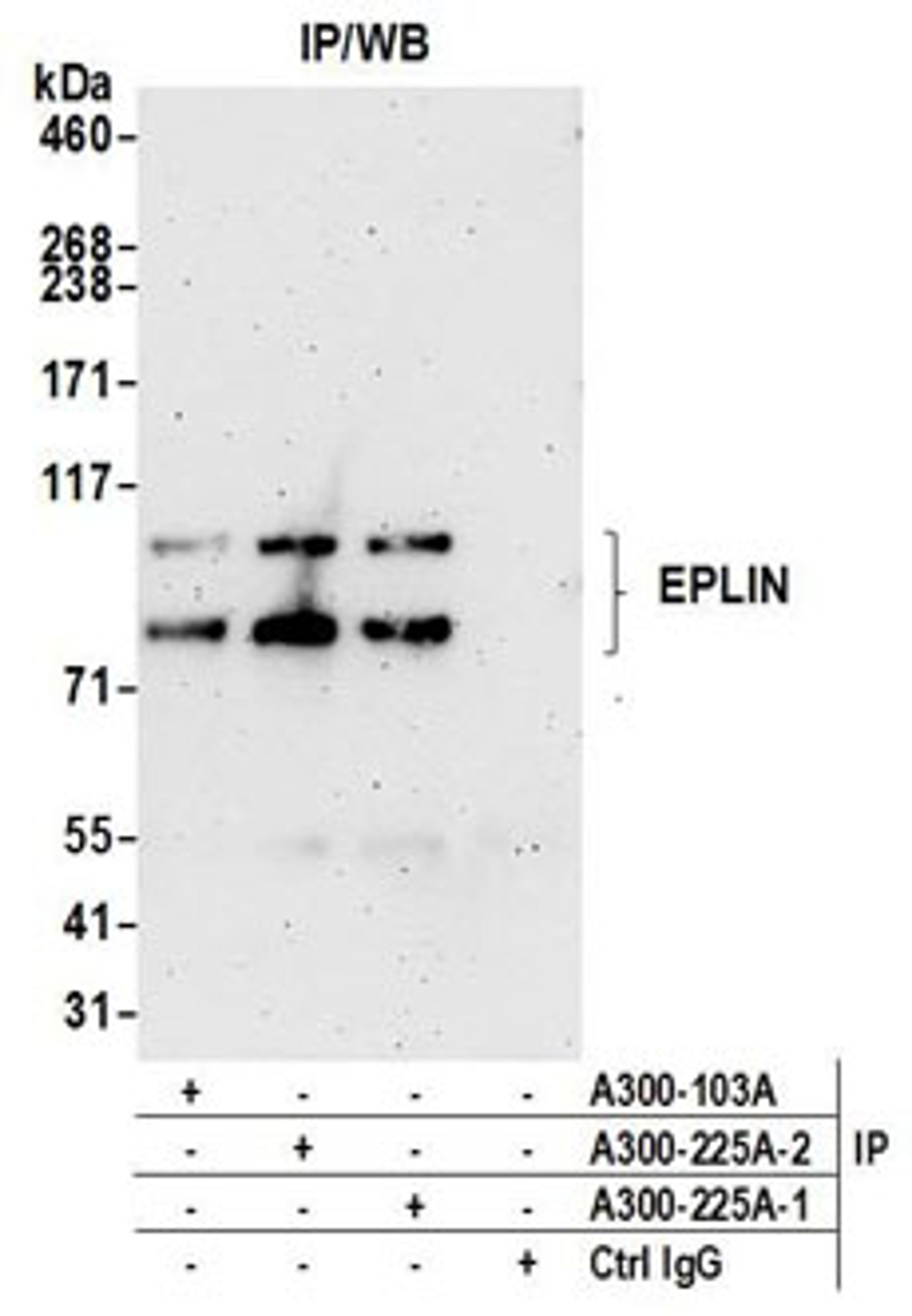 Detection of human EPLIN by western blot of immunoprecipitates.