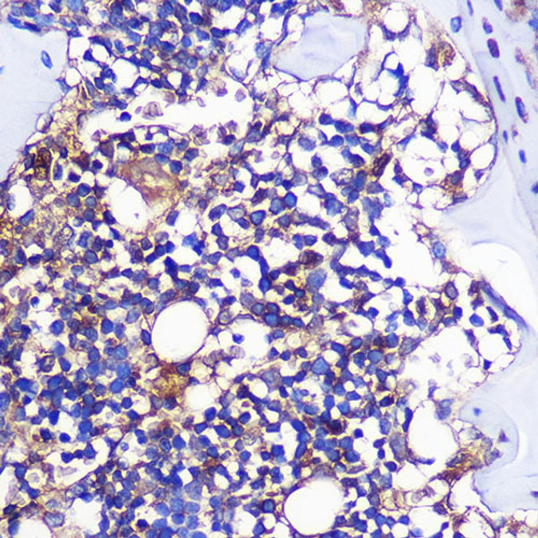 Immunohistochemistry  - CCR1 Rabbit pAb (A18341)