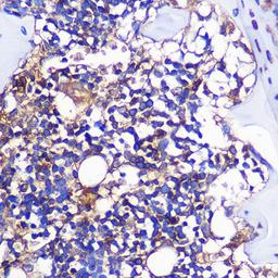 Immunohistochemistry  - CCR1 Rabbit pAb (A18341)