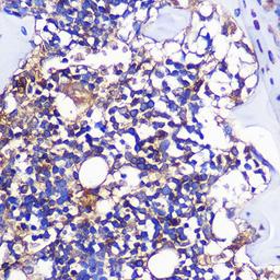 Immunohistochemistry - CCR1 Rabbit pAb (A18341)