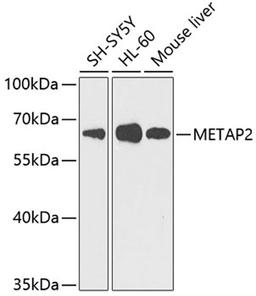 Western blot - METAP2 antibody (A5962)