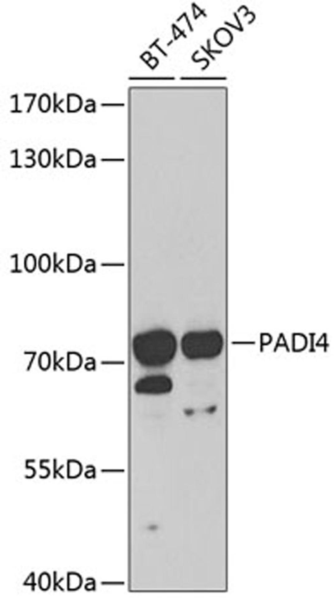 Western blot - PADI4 antibody (A1906)