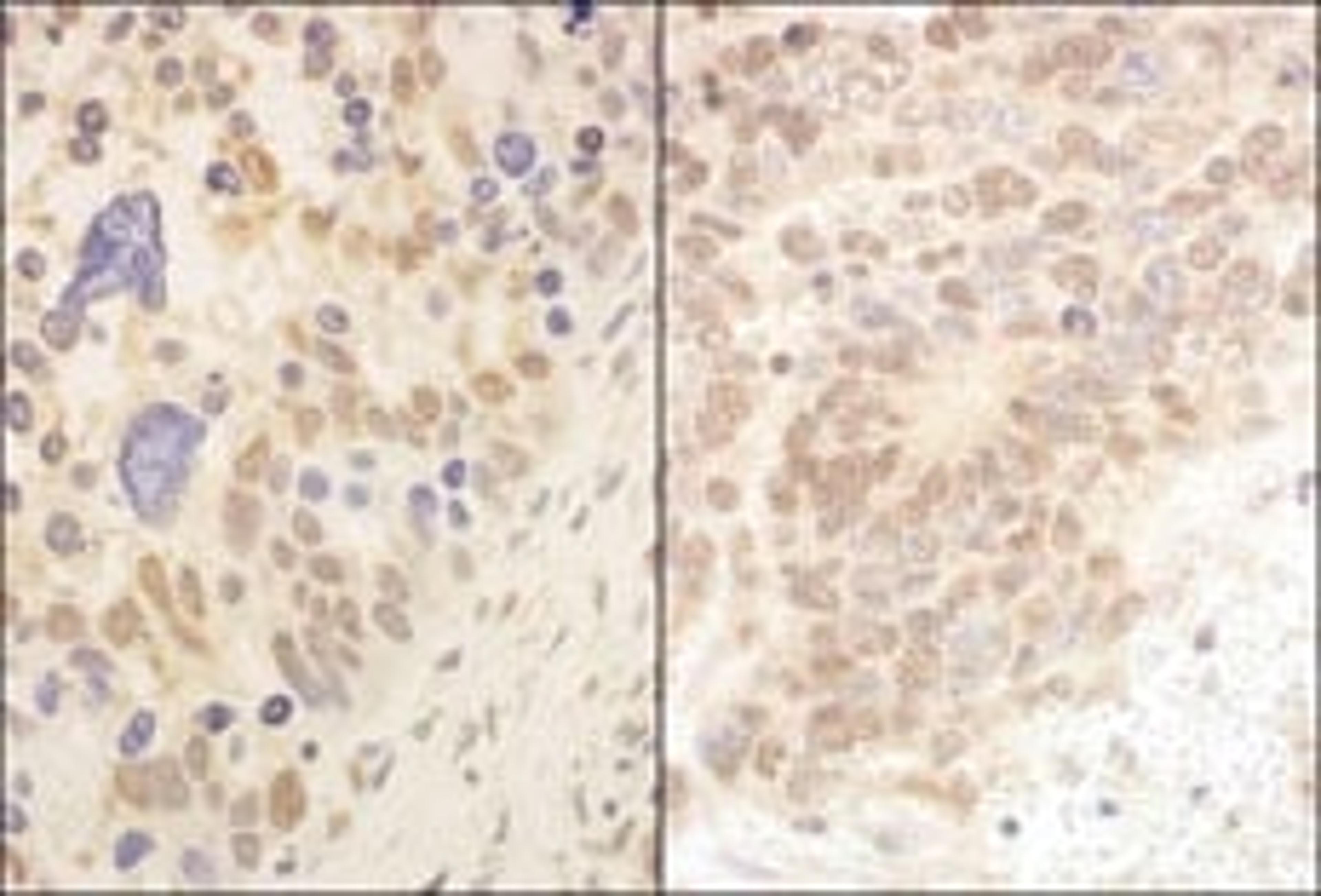 Detection of human and mouse Cul2 by immunohistochemistry.