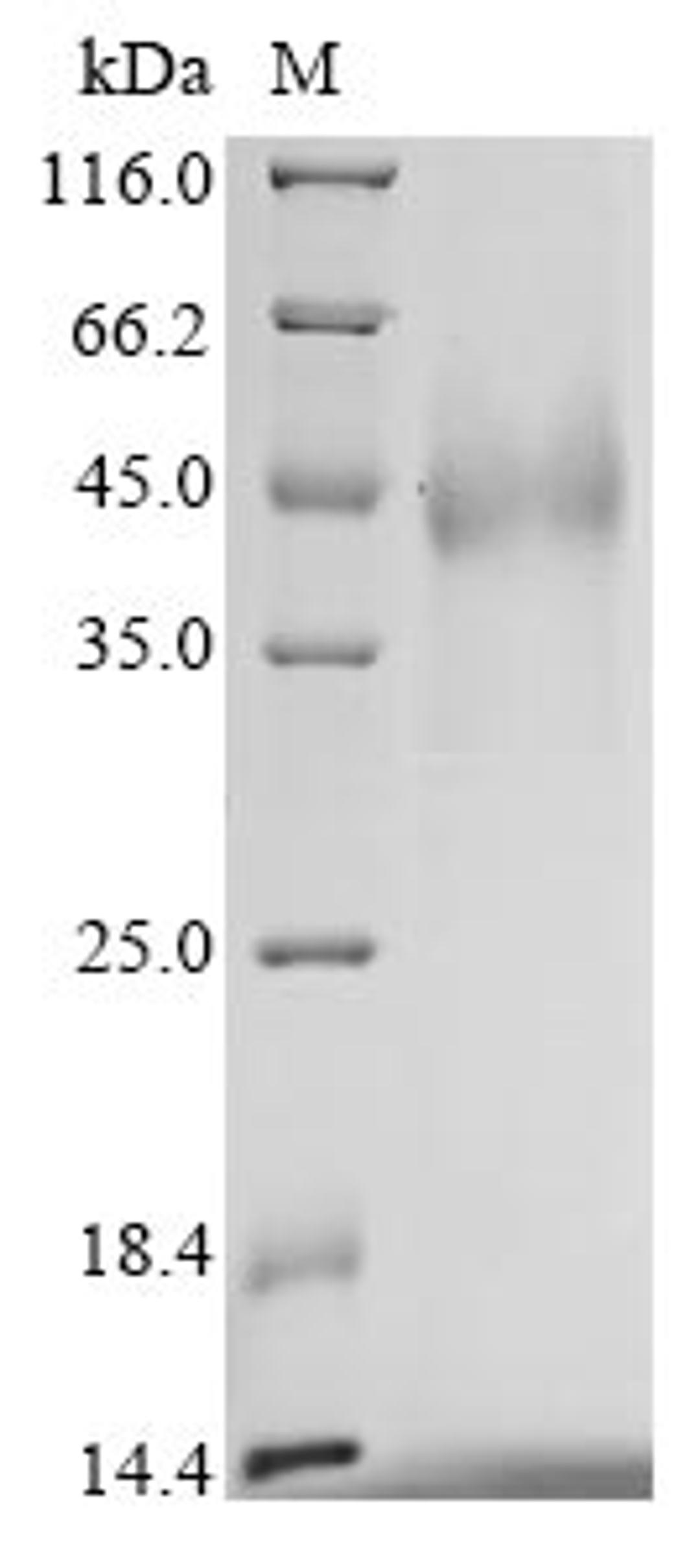 (Tris-Glycine gel) Discontinuous SDS-PAGE (reduced) with 5% enrichment gel and 15% separation gel.