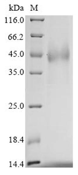 (Tris-Glycine gel) Discontinuous SDS-PAGE (reduced) with 5% enrichment gel and 15% separation gel.