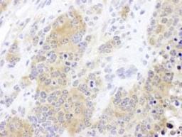 Detection of mouse CCT2 by immunohistochemistry.