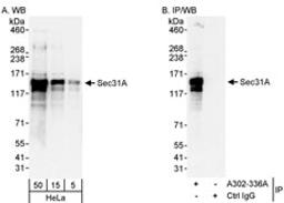 Detection of human Sec31A by western blot and immunoprecipitation.