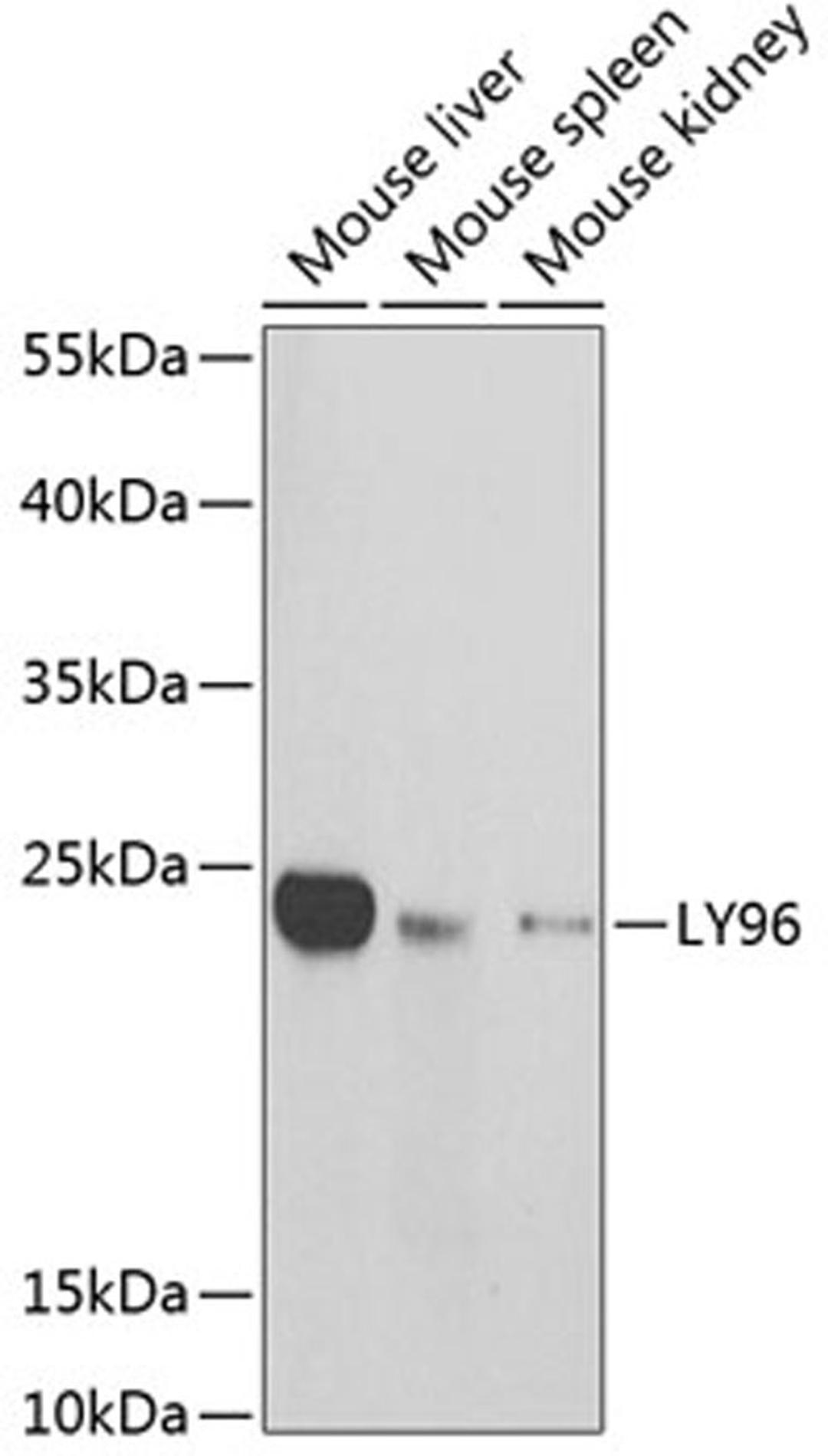 Western blot - LY96 antibody (A1866)