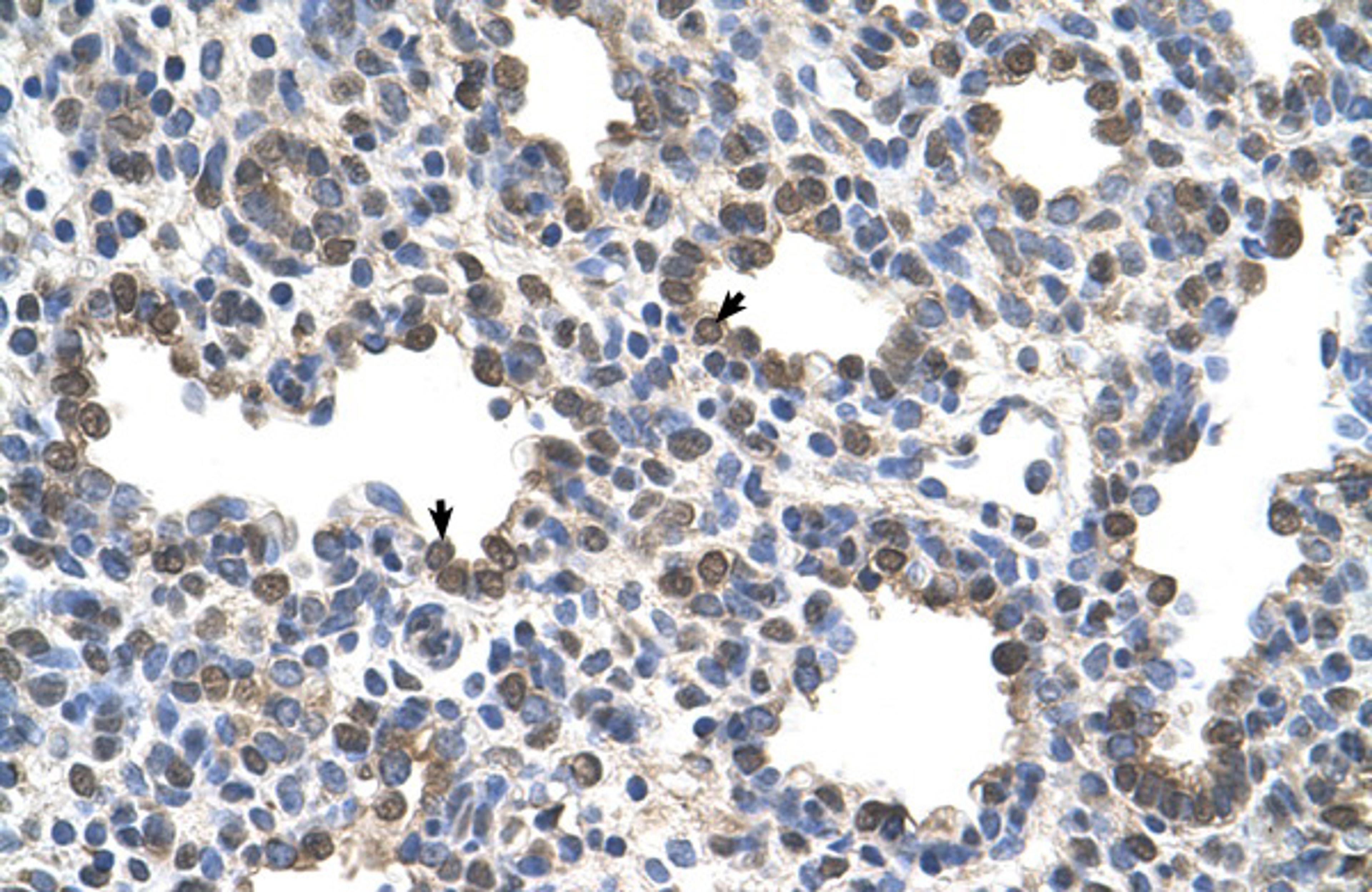 Antibody used in IHC on Human Lung.