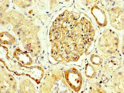 IHC image of CSB-PA015988LA01HU diluted at 1:250 and staining in paraffin-embedded human kidney tissue performed on a Leica BondTM system. After dewaxing and hydration, antigen retrieval was mediated by high pressure in a citrate buffer (pH 6.0). Section was blocked with 10% normal goat serum 30min at RT. Then primary antibody (1% BSA) was incubated at 4°C overnight. The primary is detected by a biotinylated secondary antibody and visualized using an HRP conjugated SP system.