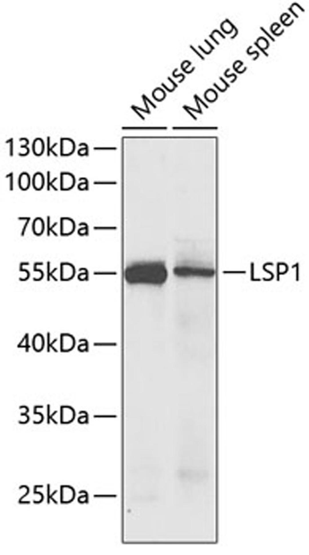 Western blot - LSP1 antibody (A5617)