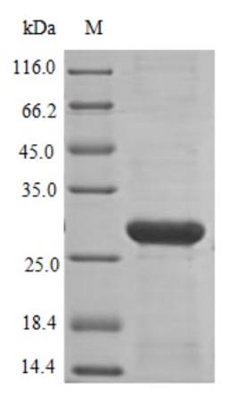 (Tris-Glycine gel) Discontinuous SDS-PAGE (reduced) with 5% enrichment gel and 15% separation gel.