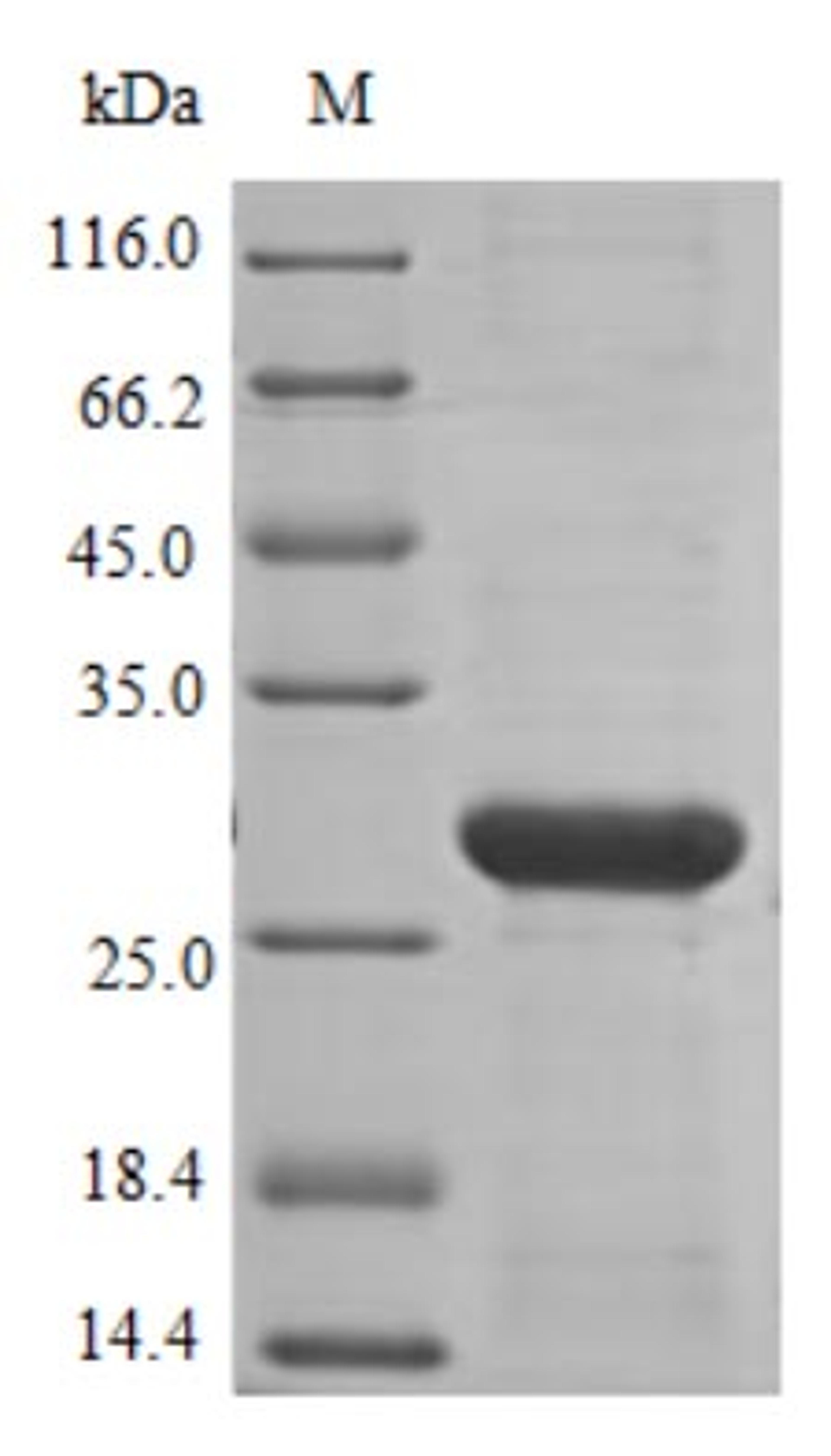 (Tris-Glycine gel) Discontinuous SDS-PAGE (reduced) with 5% enrichment gel and 15% separation gel.