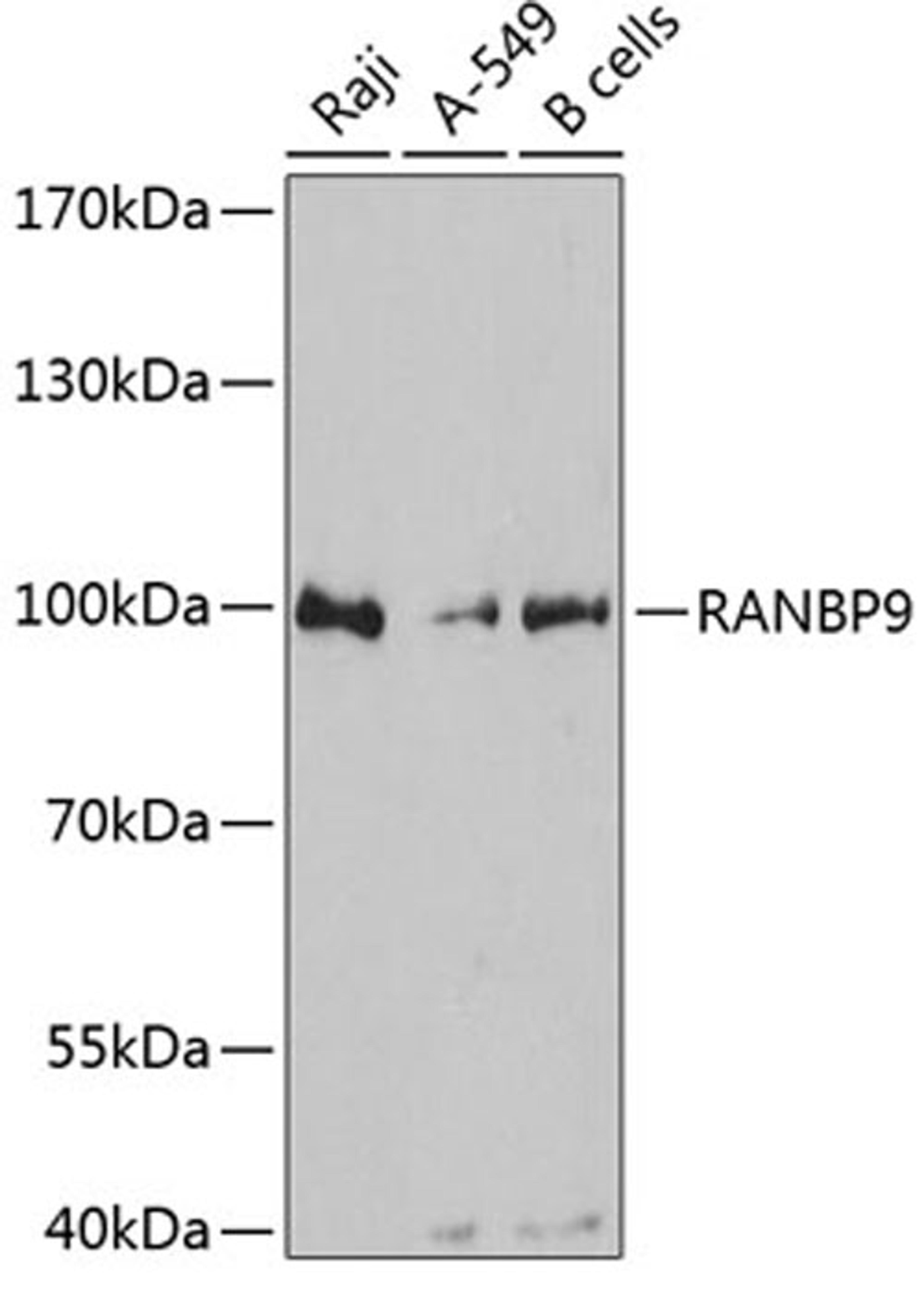 Western blot - RANBP9 antibody (A12097)