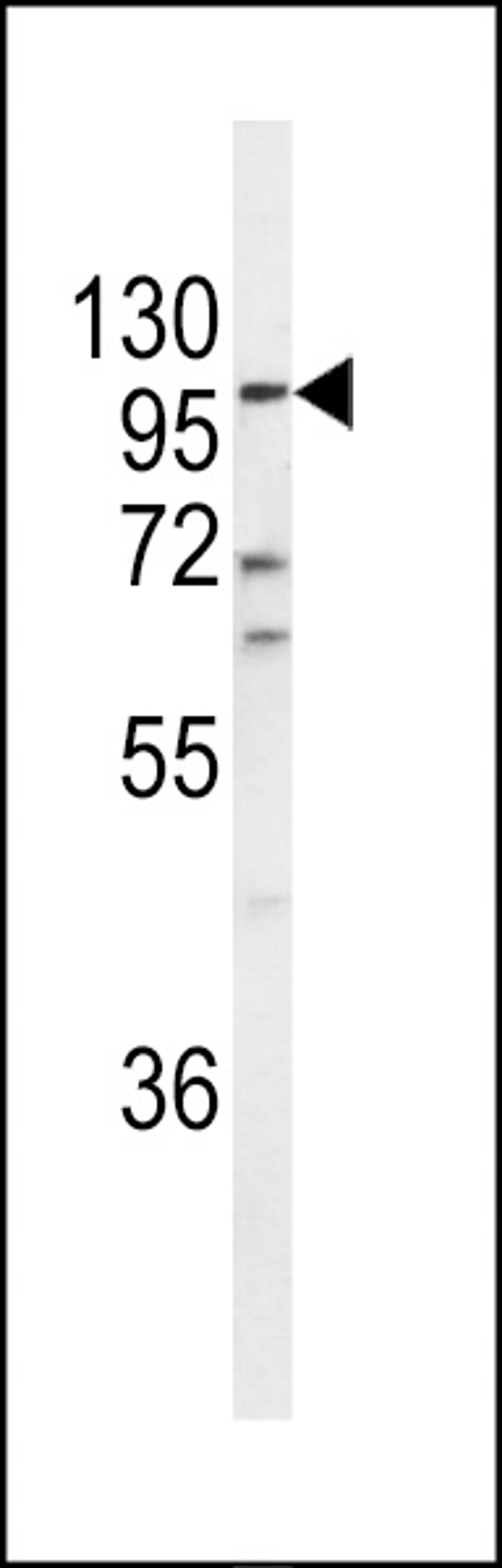 Western blot analysis of ECE-1 Antibody in A2058 cell line lysates (35ug/lane)