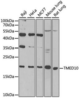 Western blot - TMED10 antibody (A6771)