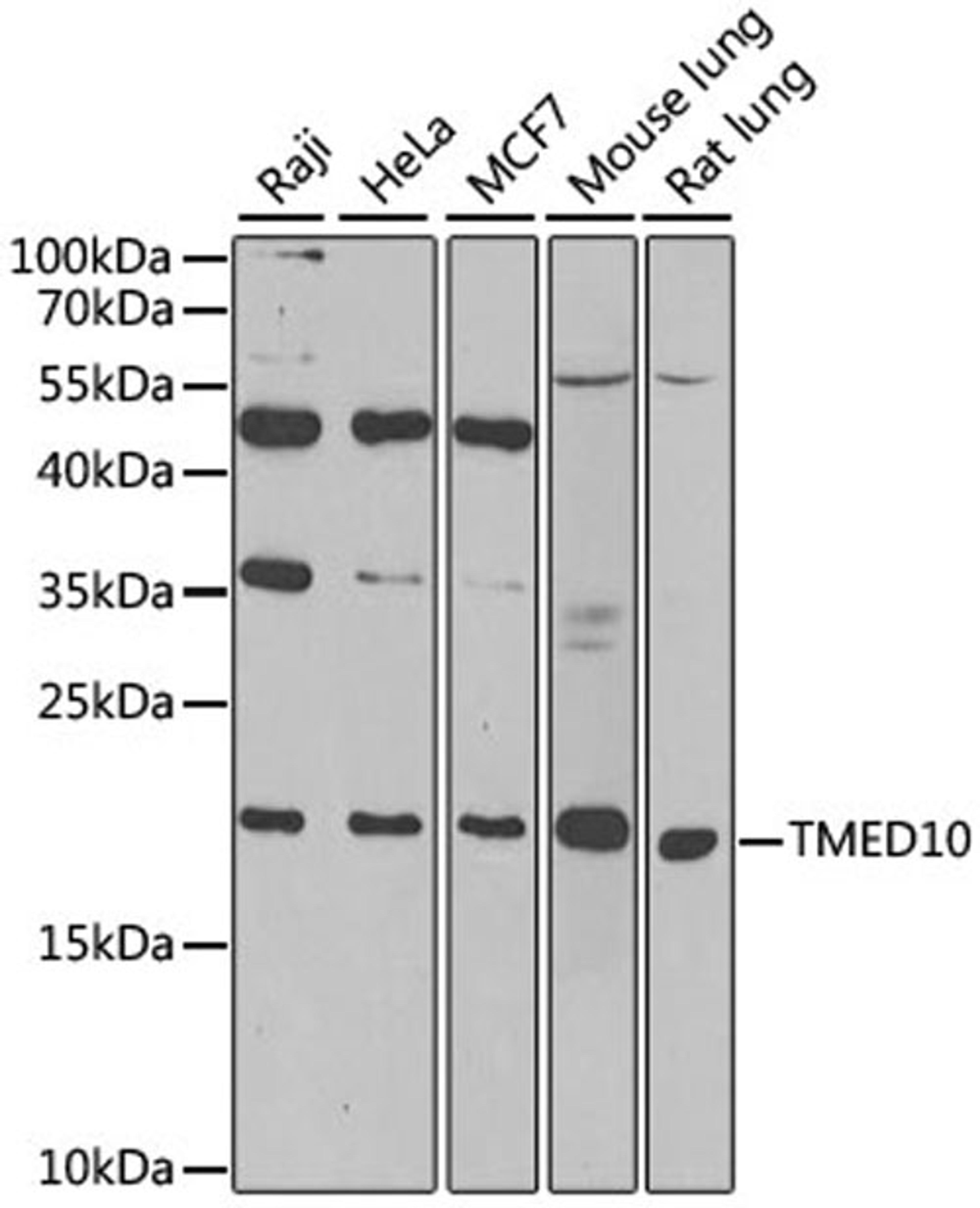 Western blot - TMED10 antibody (A6771)